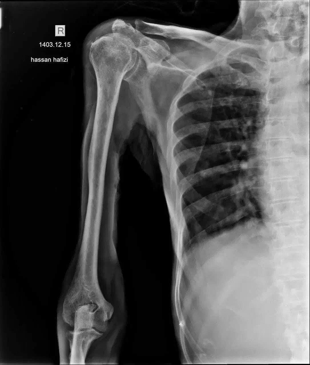 رادیولوژی در منزل|خدمات آرایشگری و زیبایی|قم, سالاریه|دیوار