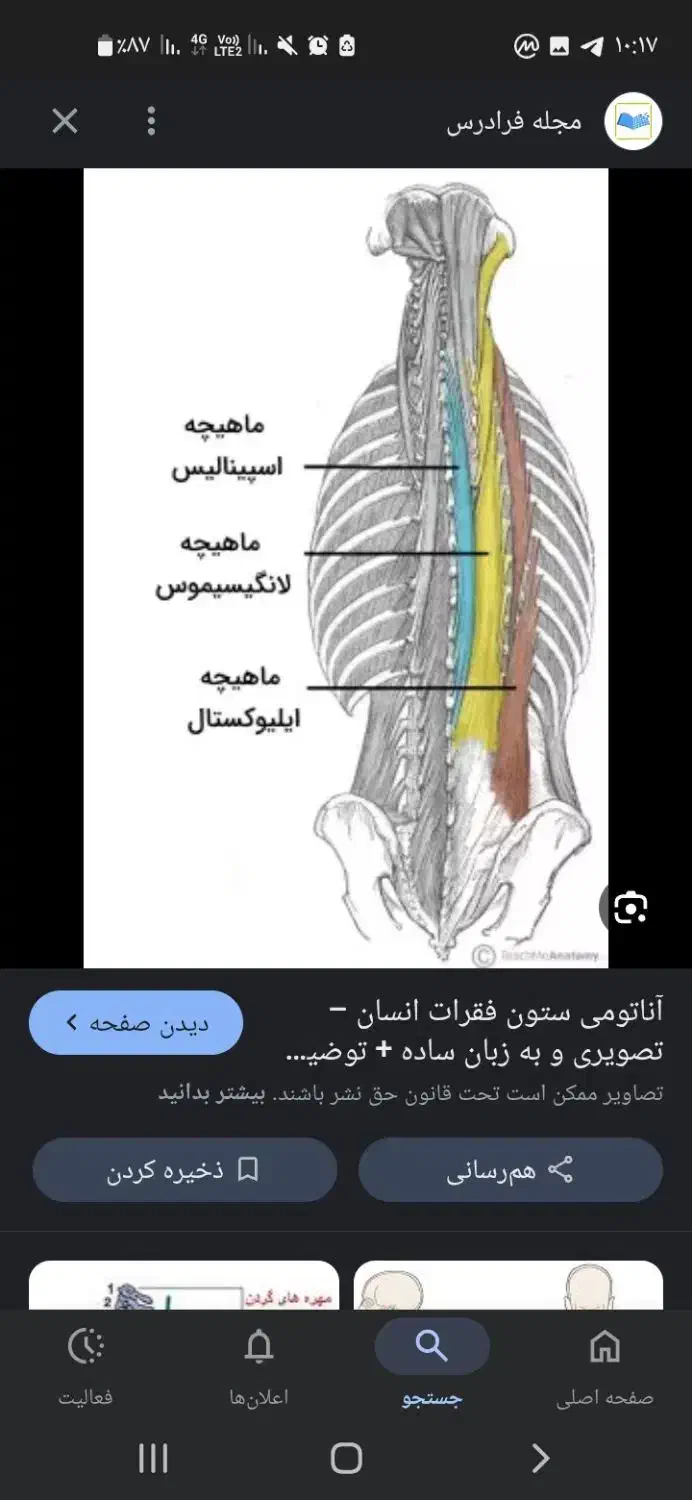 درمان افرادسکته ای .سیاتیک بیحسی دست|خدمات آرایشگری و زیبایی|نیشابور, کوی یغما|دیوار