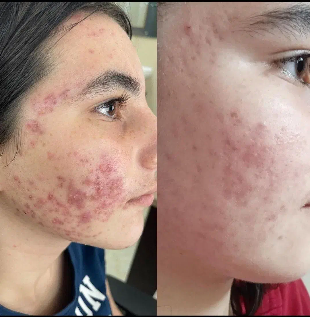 پاکسازی کبد چرب فقط در ۴۰ روز|آرایشی، بهداشتی، درمانی|گنبد کاووس, |دیوار