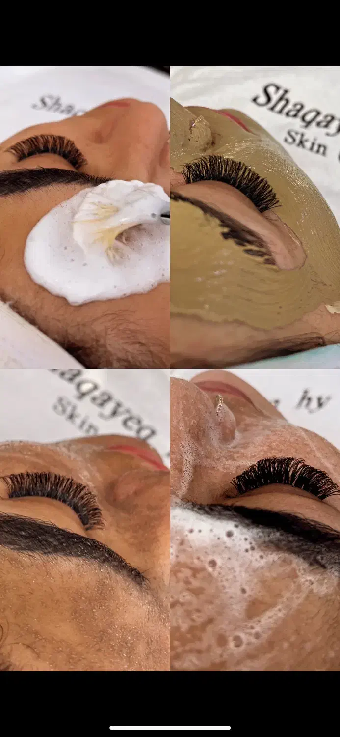 اموزش تخصصی خدمات  فیشیال پاکسازی پوست مزونیدلینگ|خدمات آموزشی|اصفهان, خانه اصفهان|دیوار