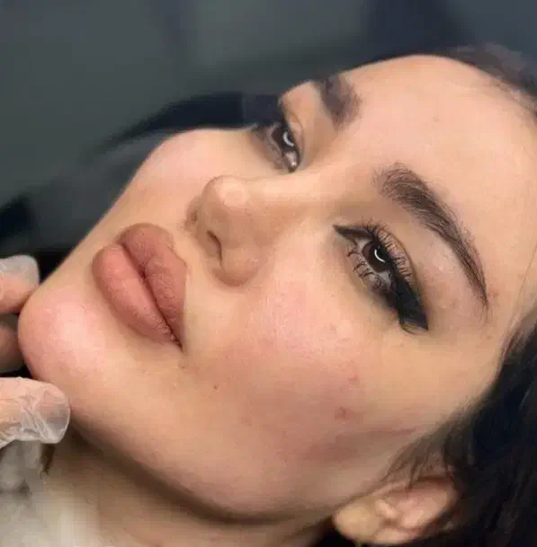 جشنواره زیبایی((مدل ژل وبوتاکس))|خدمات آرایشگری و زیبایی|سنندج, |دیوار