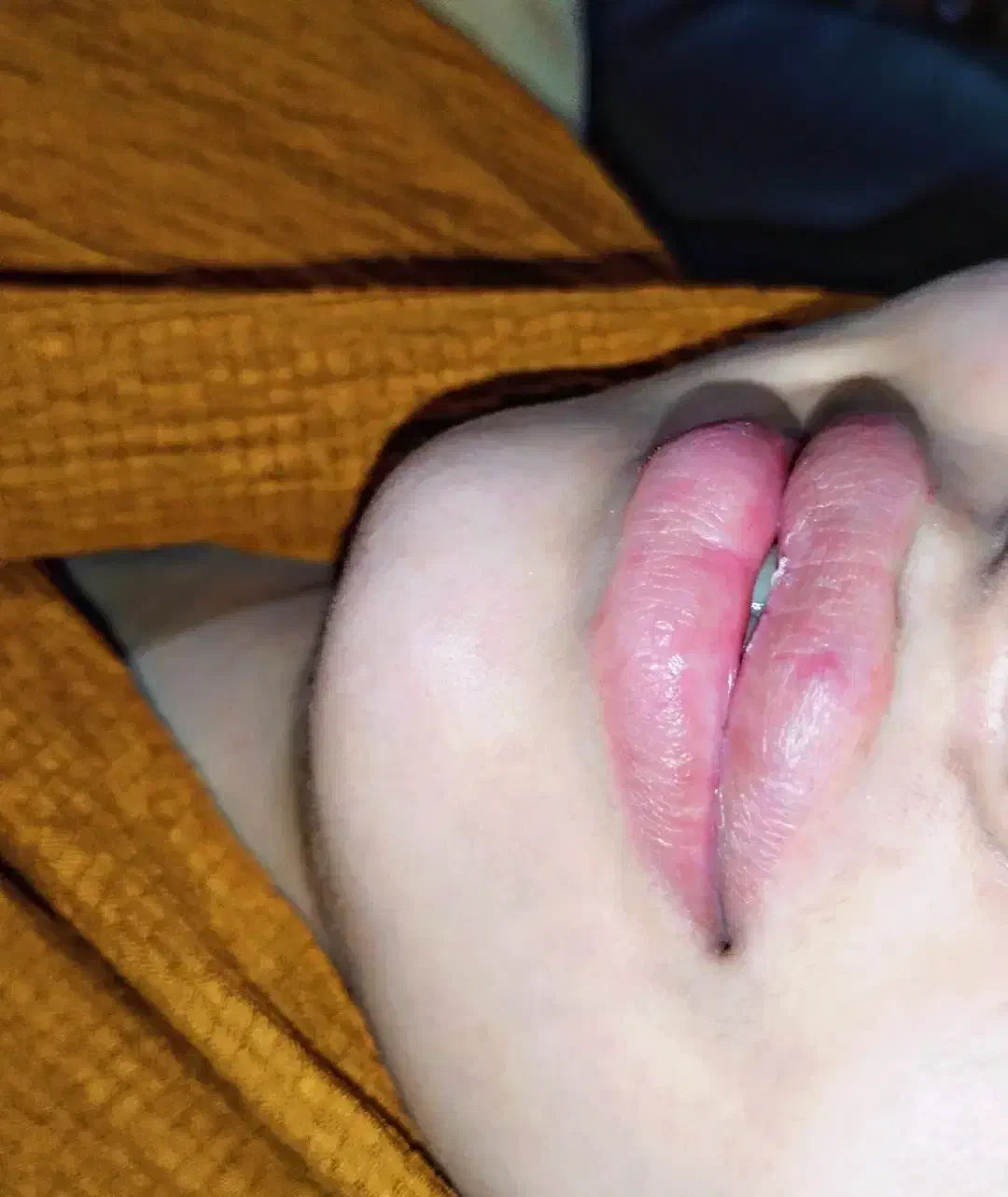 جشنواره تزریق ژل بدون درد و کبودی تضمینی|خدمات آرایشگری و زیبایی|جیرفت, |دیوار