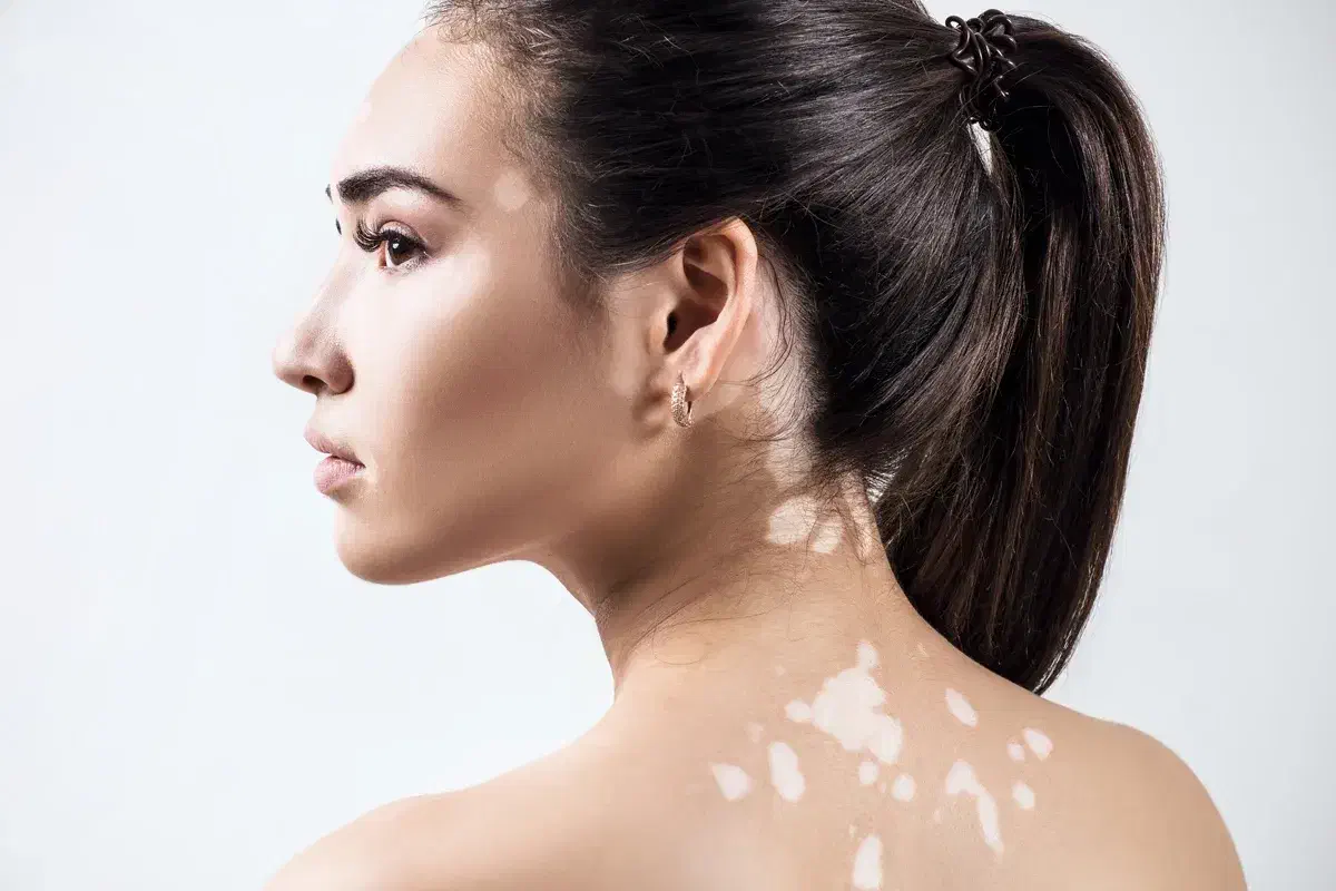 بصورت ریشه ای درمان و(یتلیگو پیسی)|آرایشی، بهداشتی، درمانی|سنندج, |دیوار