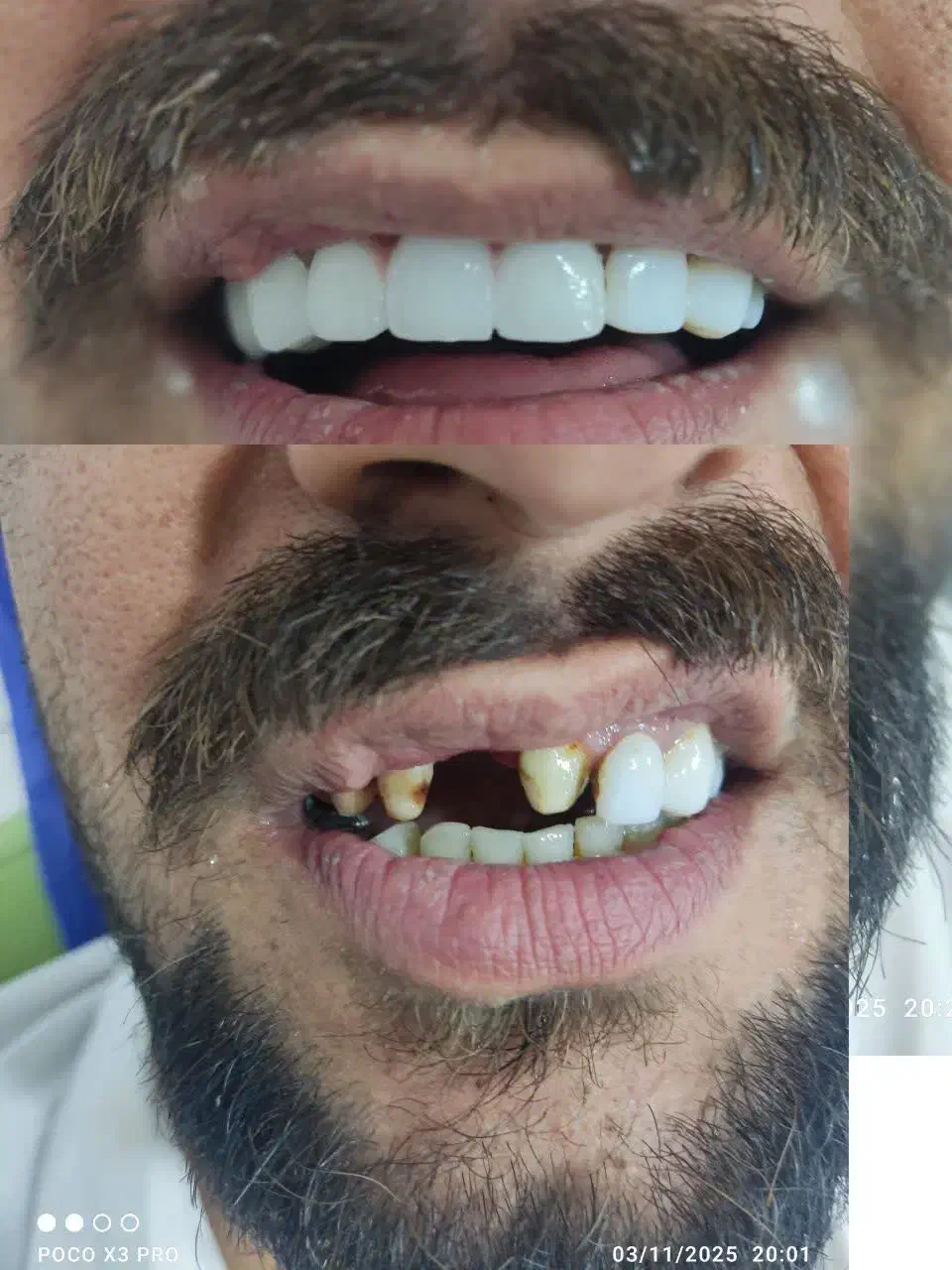 دندانپزشکی صدف (با شرایط اقساط) کامپوزیت|خدمات آرایشگری و زیبایی|قم, حقیقت|دیوار