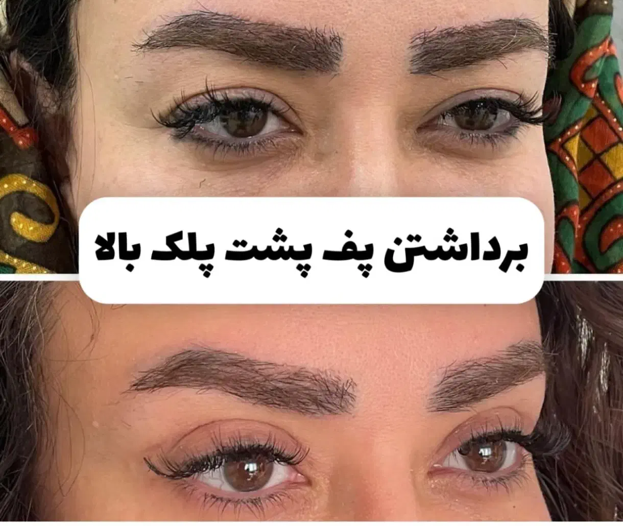 جشنوراه جراحی پلک بالا بلفاروپلاستی|خدمات آرایشگری و زیبایی|اصفهان, خانه اصفهان|دیوار