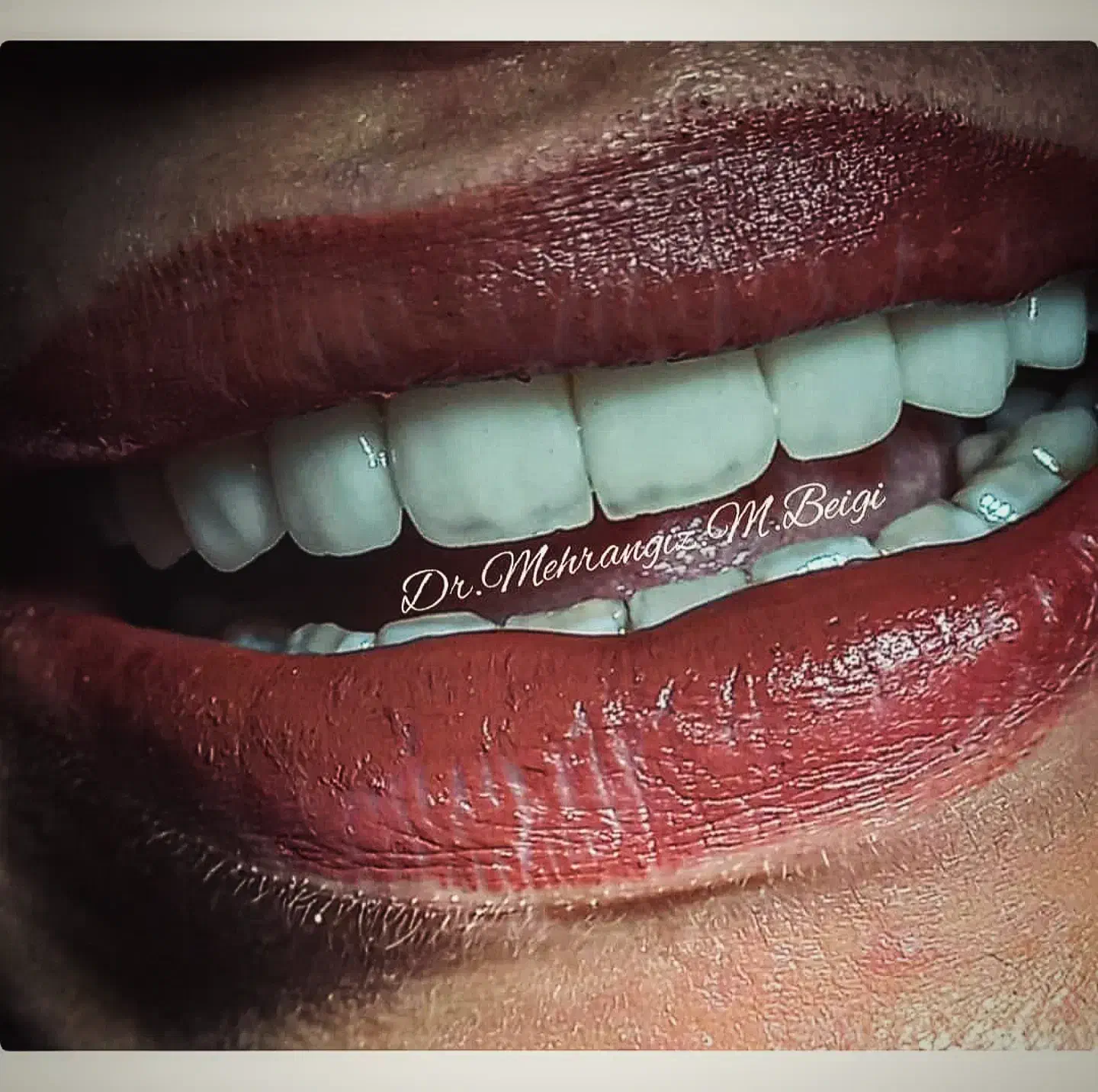 دندانپزشکی زیبایی و لمینت|خدمات آرایشگری و زیبایی|تهران, سلیمانی|دیوار