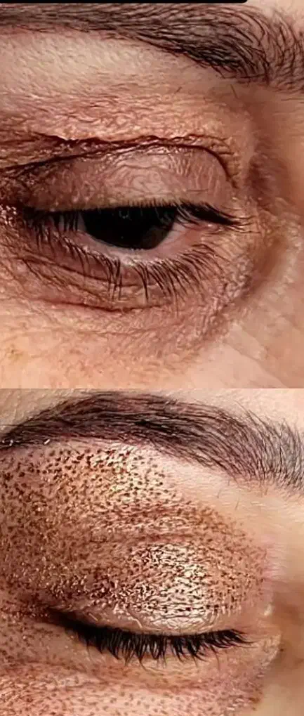 کک و مک،پلاسما،خالبرداری،جوانسازی|خدمات آرایشگری و زیبایی|شیراز, ستارخان|دیوار