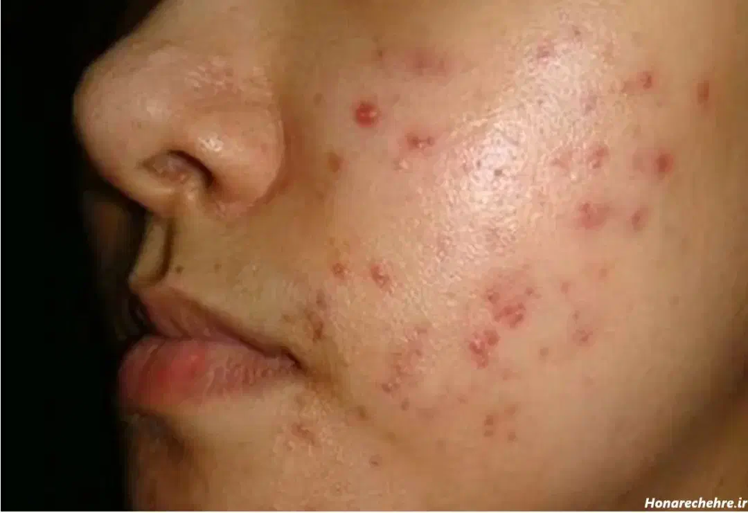 زیبایی صورت.|خدمات آرایشگری و زیبایی|بروجرد, |دیوار