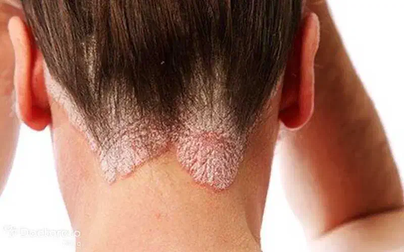 پیسی|آرایشی، بهداشتی، درمانی|تهران, امیریه|دیوار