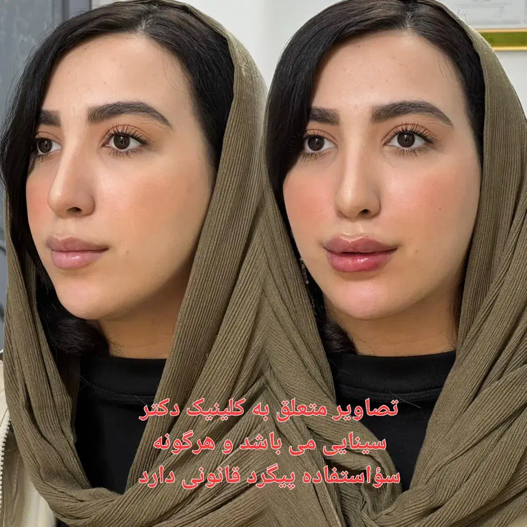 تزریق ژل و بوتاکس و لیزر در مطمئن ترین کلینیک مشهد|خدمات آرایشگری و زیبایی|مشهد, احمدآباد|دیوار