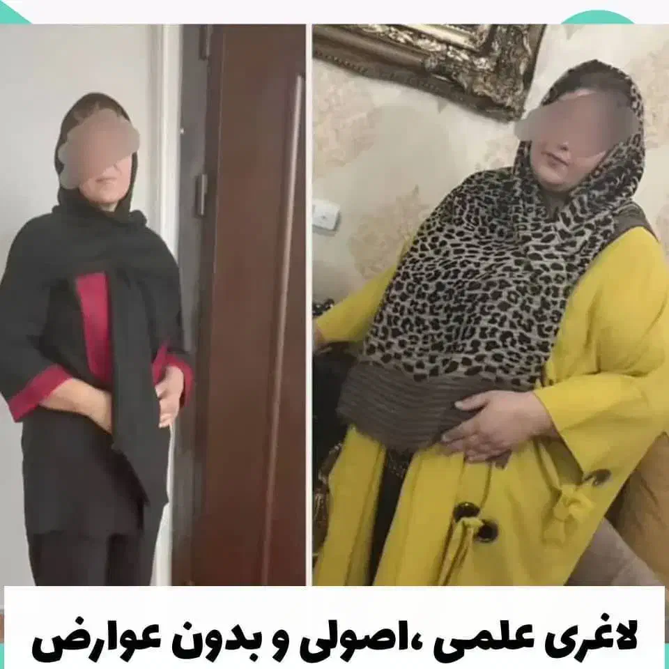 مث کره چربی سوزی کن|خدمات آرایشگری و زیبایی|زنجان, |دیوار