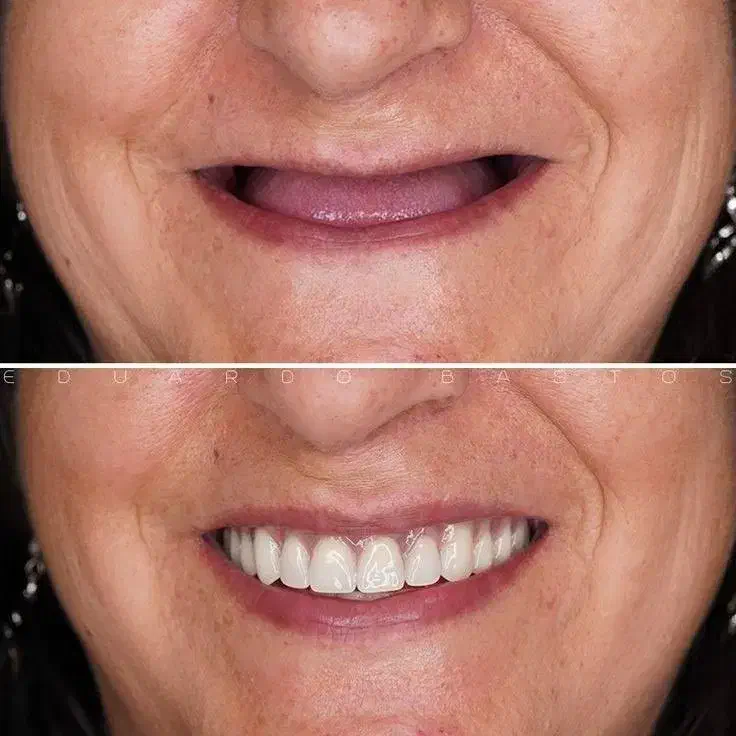 مرکز تخصصی دندانپزشکی ایمپلنت شرایط ویژه اقساطی|خدمات آرایشگری و زیبایی|تبریز, |دیوار