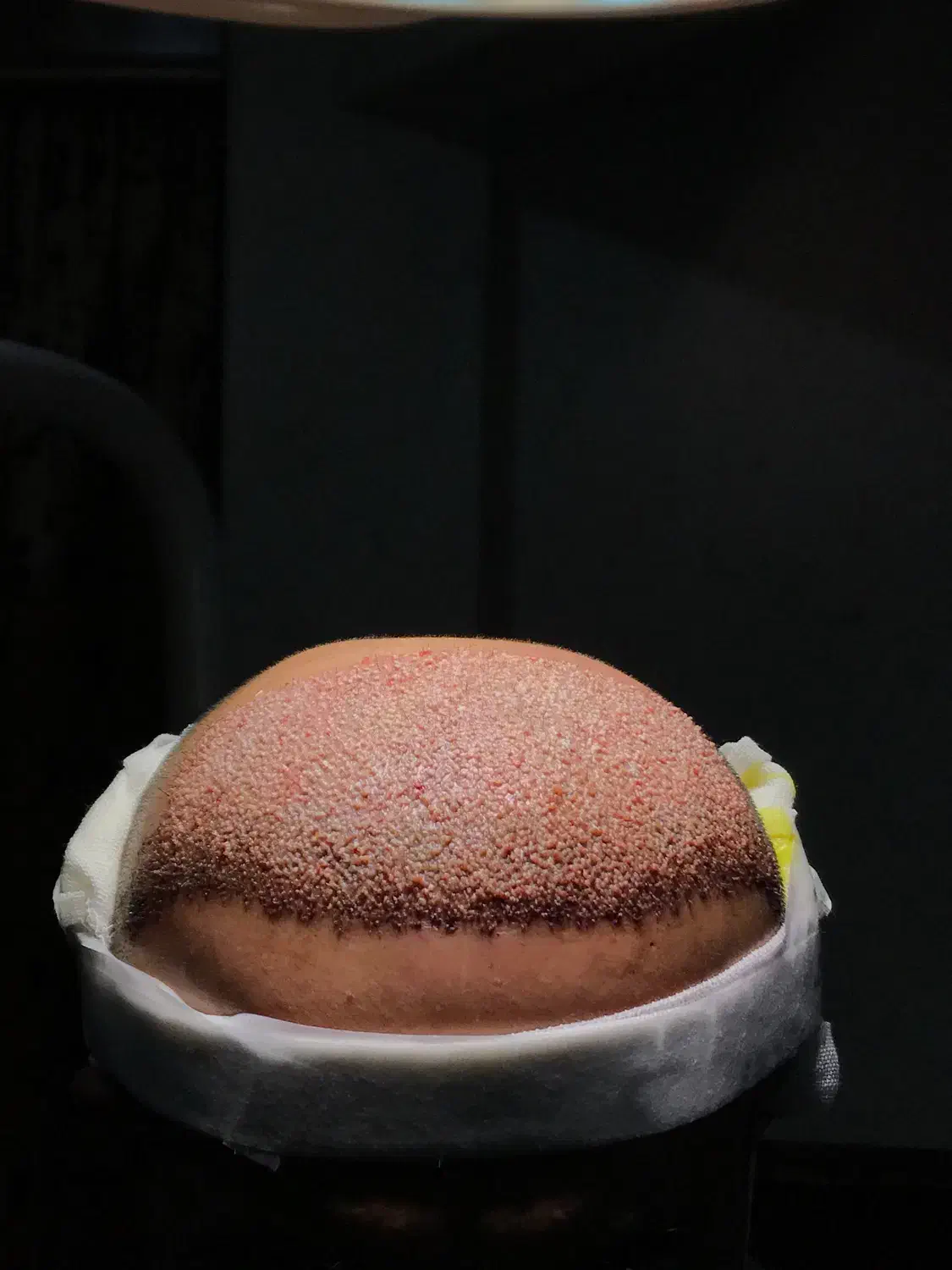 کاشت مو تخصصی در اردبیل|خدمات آرایشگری و زیبایی|اردبیل, |دیوار