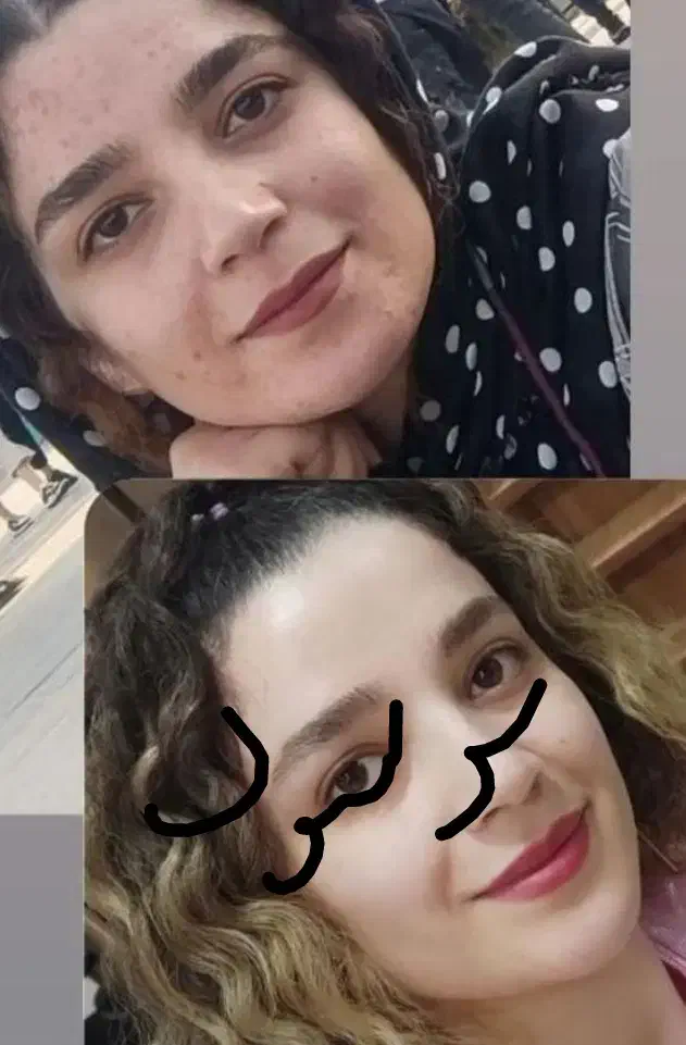 روشن کننده وضدلک درمانی بدون بازگشت تضمینی|آرایشی، بهداشتی، درمانی|یاسوج, |دیوار