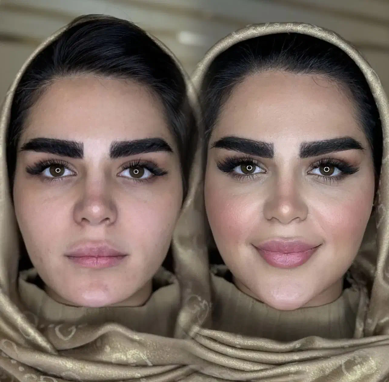 تخفیف خدمات مدلینگ فیلر بوتاکس مزوژل خانم و آقا|خدمات آرایشگری و زیبایی|تهران, پاسداران|دیوار