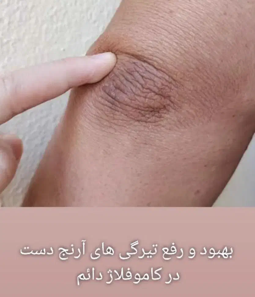 کاموفلاژ دائم|خدمات آرایشگری و زیبایی|تهران, بوستان چیتگر|دیوار