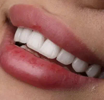 منشی و دستیار  مطب دندانپزشکی|استخدام درمانی، زیبایی، بهداشتی|تبریز, |دیوار