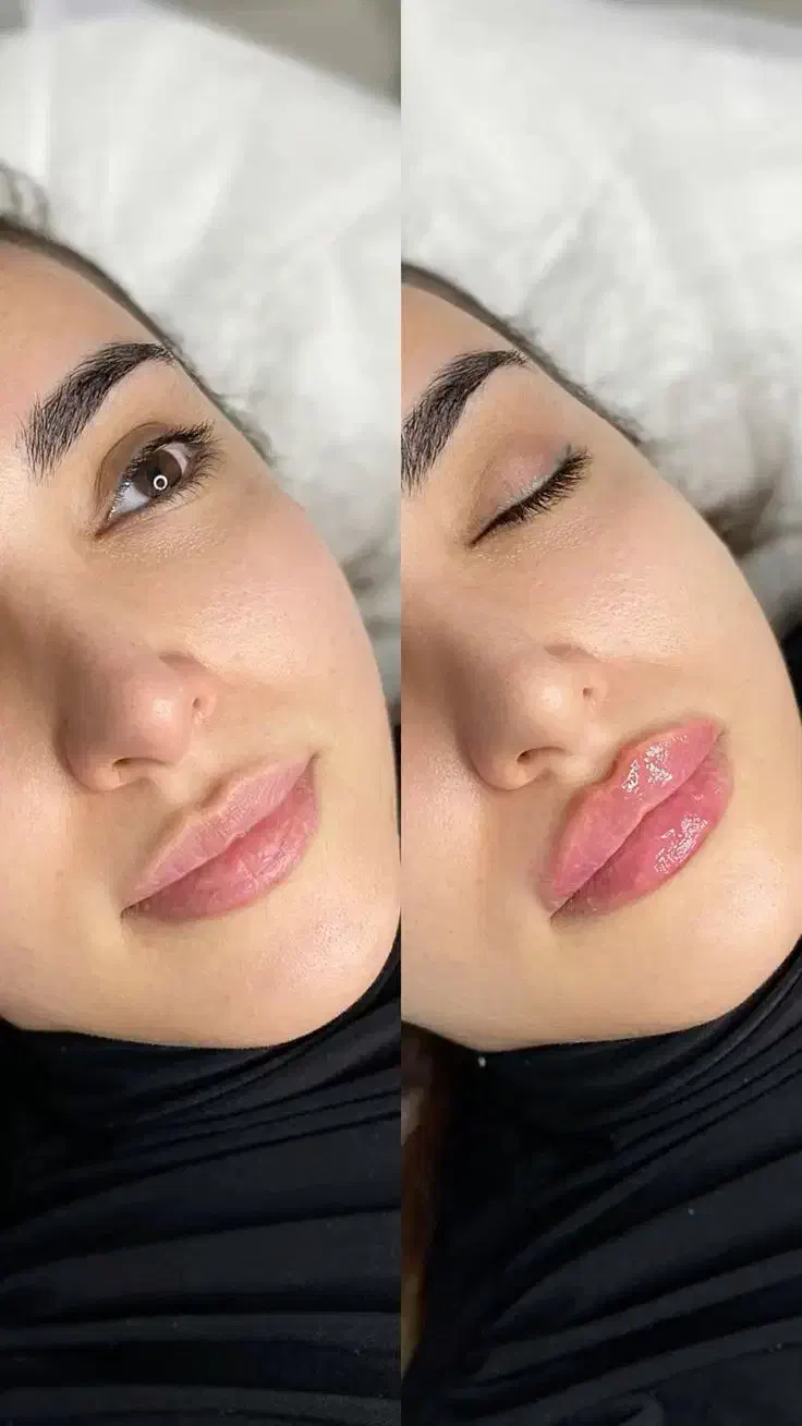 جشنواره تخفیفی کلینیک زیبایی الینور|خدمات آرایشگری و زیبایی|شاهین‌شهر, عطار|دیوار