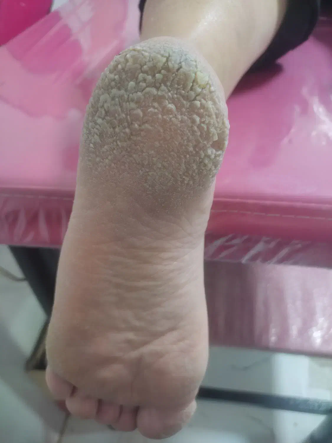 پاکسازی پوست.خدمات ناخن.پدیکورتخصصی .پارافین|خدمات آرایشگری و زیبایی|تویسرکان, |دیوار