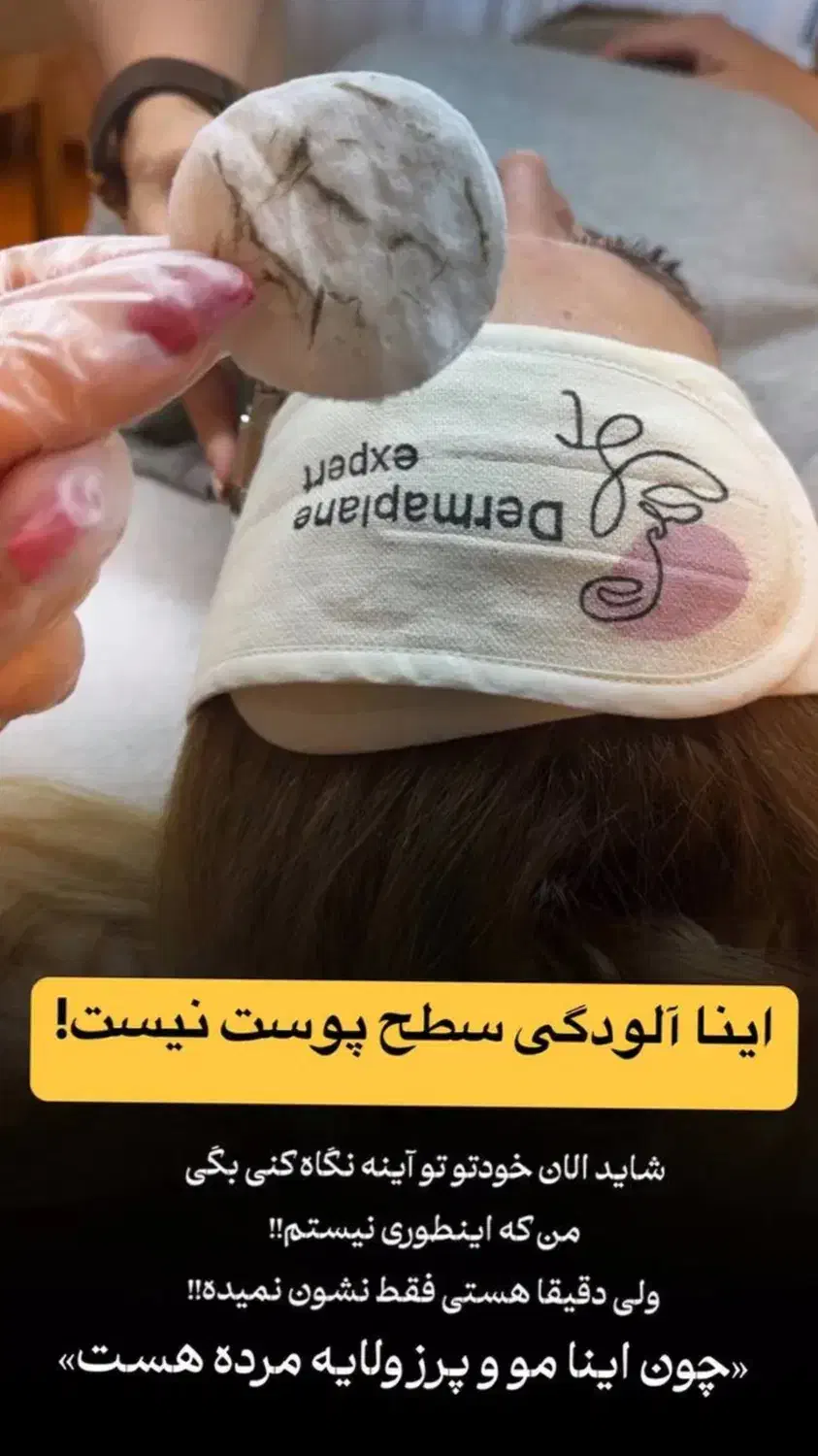 پاکسازی پوست فیشیال|خدمات آرایشگری و زیبایی|لردگان, |دیوار