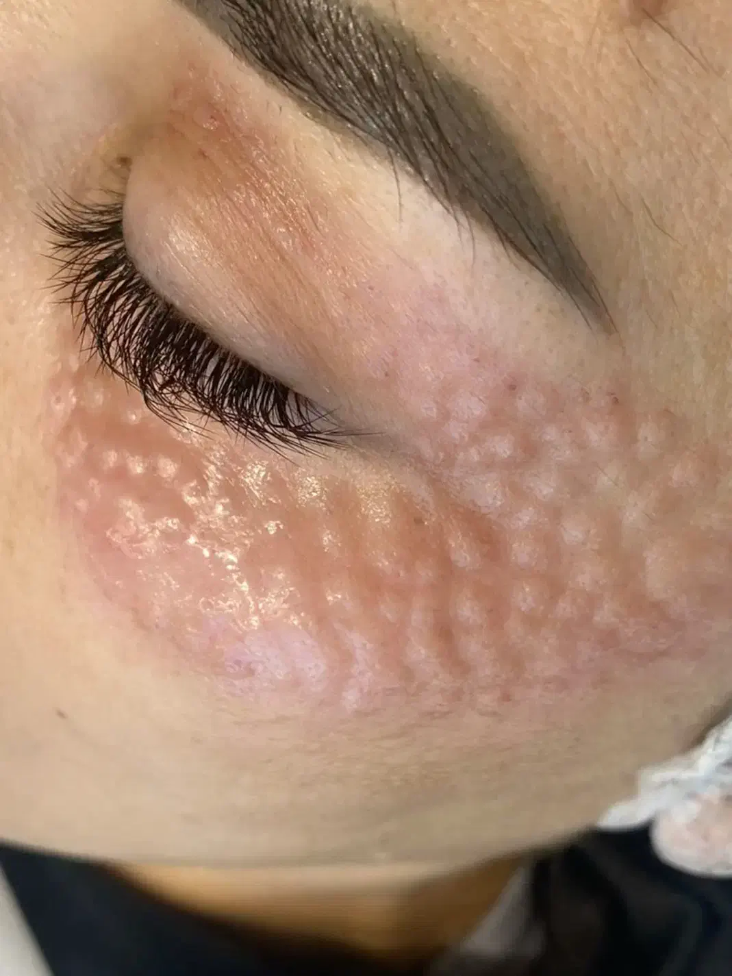 جوانساز پی آر پیprp صورت و ریزش مو و زخم و لک|خدمات آرایشگری و زیبایی|هشتگرد, شهرک ولیعصر (مصلی)|دیوار