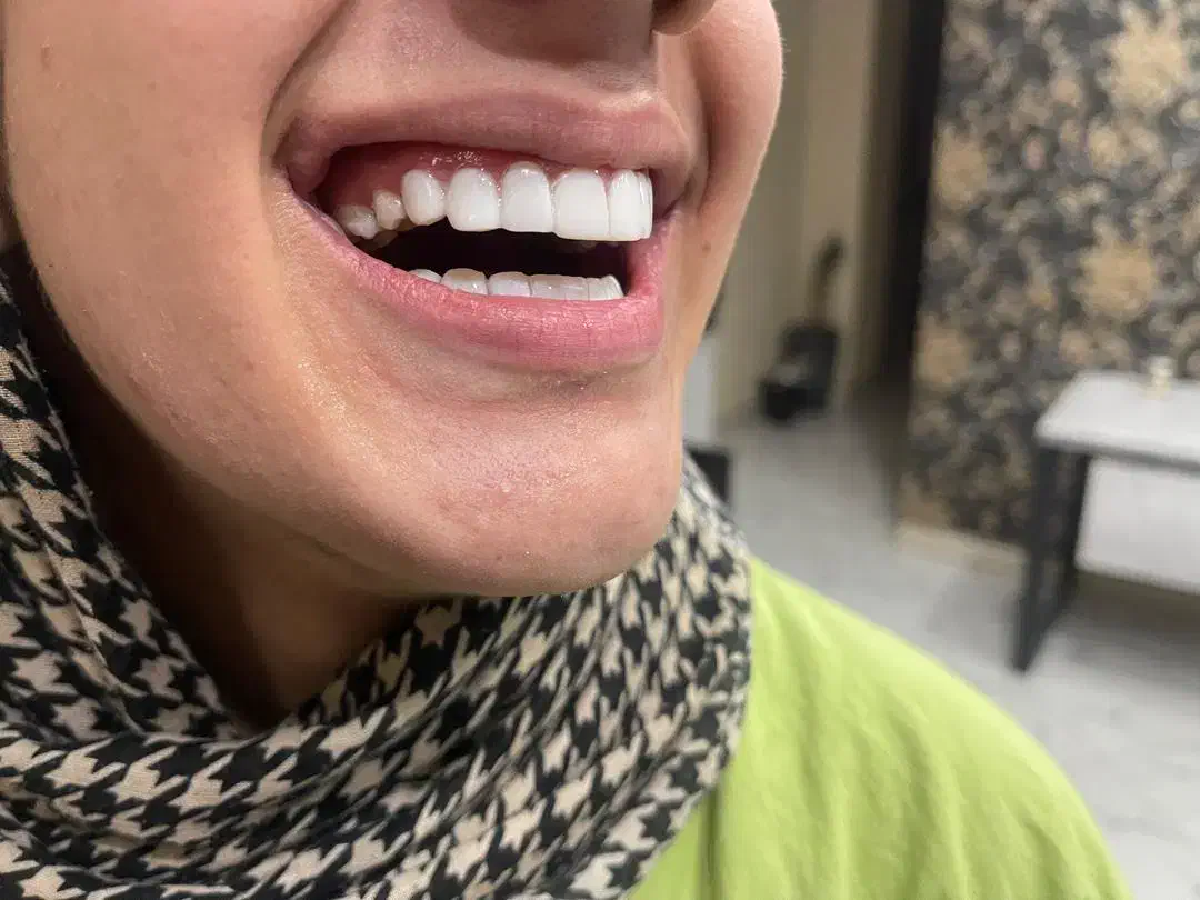 آموزش تخصصی کامپوزیت دندان با برد تخصصی|خدمات آموزشی|اندیشه, شهرک کوثر|دیوار