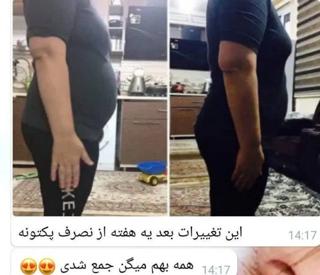 درمان چاقی با مشاوره رایگان|فعالیت داوطلبانه|ماهدشت, |دیوار