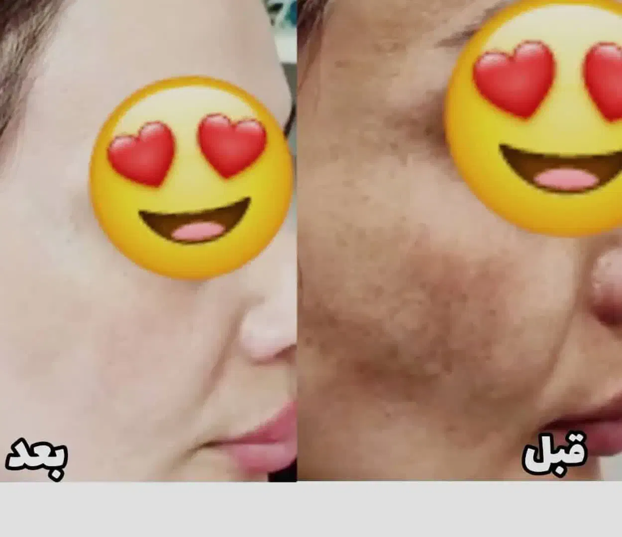 چند منظوره تخصصی ضدلک|آرایشی، بهداشتی، درمانی|نیشابور, شهرک اندیشه|دیوار