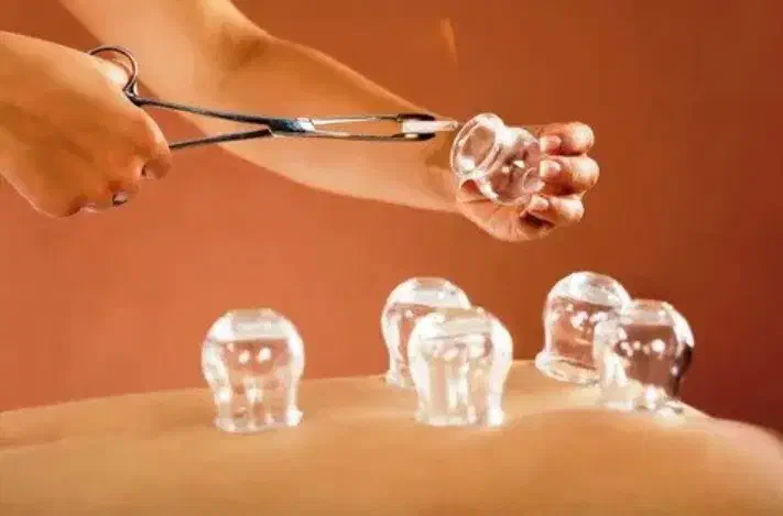 حجامت|خدمات آرایشگری و زیبایی|کویرات, |دیوار