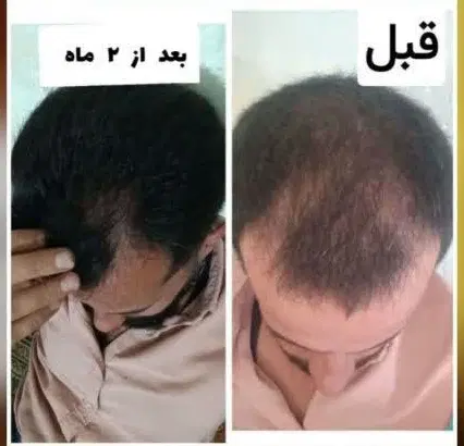 تنها نمایندگی اصلی شامپو مورینگا درتهران|آرایشی، بهداشتی، درمانی|تهران, شهرک رضویه|دیوار