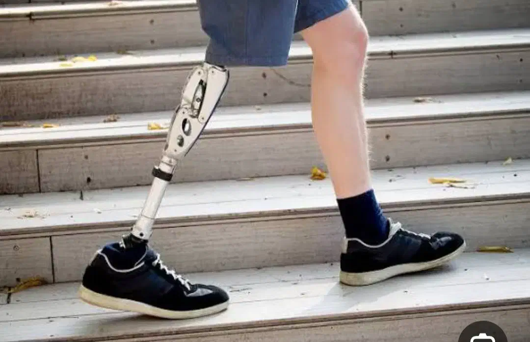 کلینیک تخصصی ساخت پروتز پیشرفته پای مصنوعی|خدمات آرایشگری و زیبایی|فامنین, |دیوار