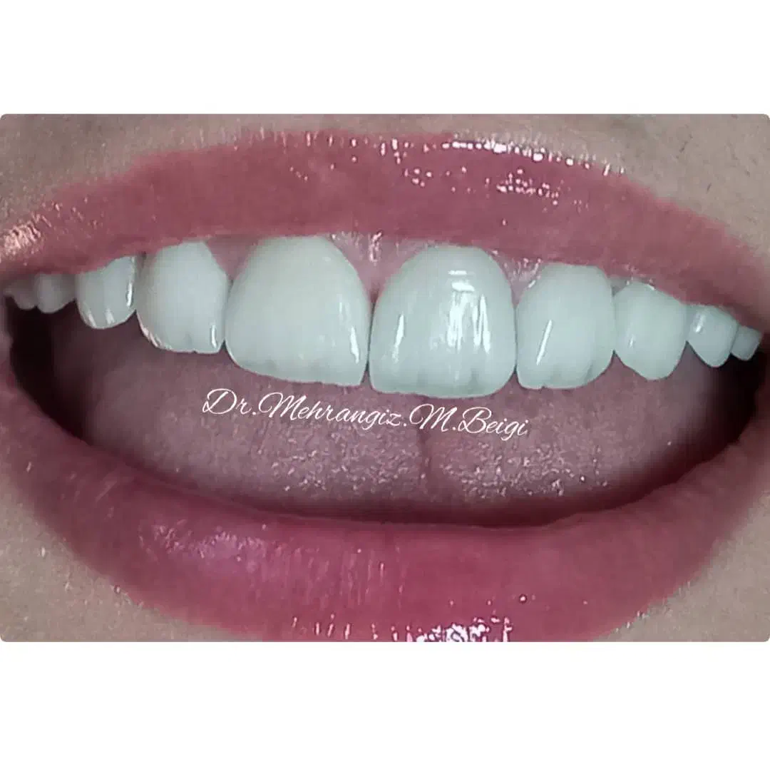 دندانپزشکی زیبایی و لمینت|خدمات آرایشگری و زیبایی|تهران, سلیمانی|دیوار