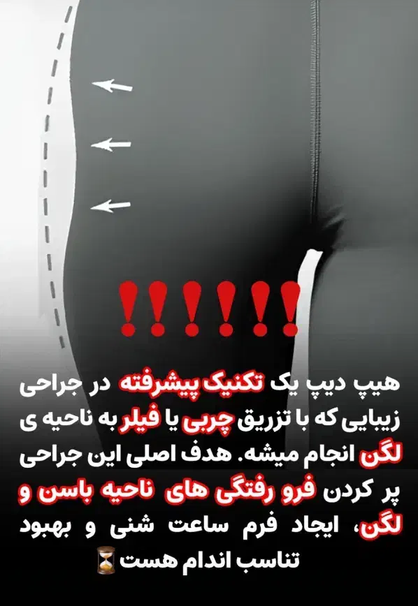 تخفیفات روزمادر تزریق ژل بوتاکس،مزوتراپی،فیلر بادی|خدمات آرایشگری و زیبایی|قم, باسکول|دیوار