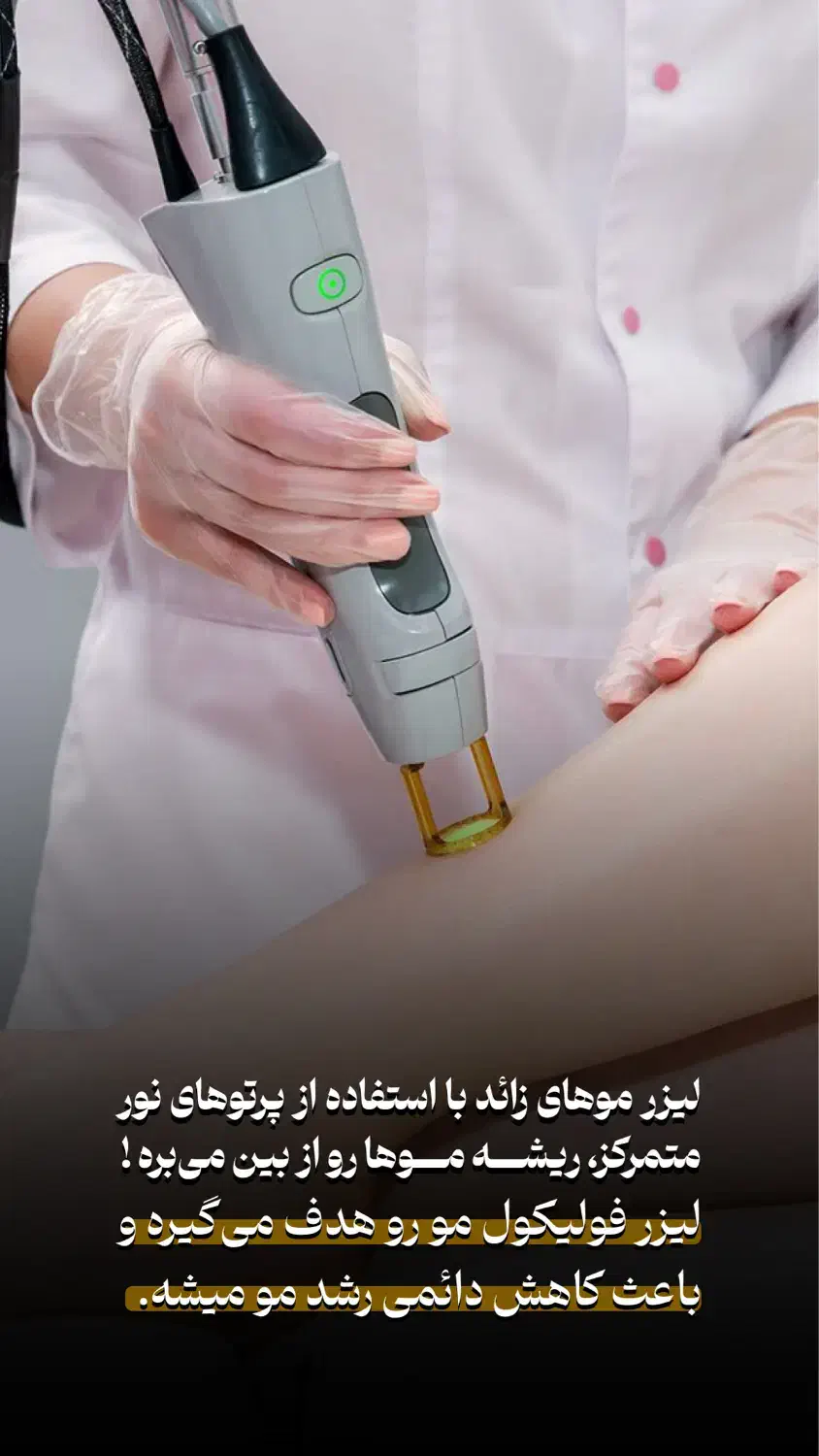 لیزر موزاید خانمها وآقایان شاتی ورولی450 هزارتومان|خدمات آرایشگری و زیبایی|تهران, فردوس|دیوار