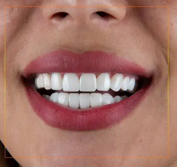 خدمات دندانپزشکی با شرایط ویژه|خدمات آرایشگری و زیبایی|زنجان, |دیوار