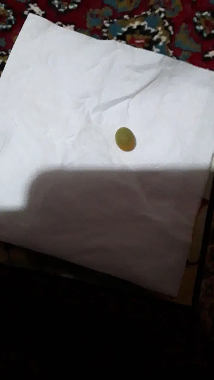 گوهر شب چراغ|جواهرات|تهران, دکتر هوشیار|دیوار