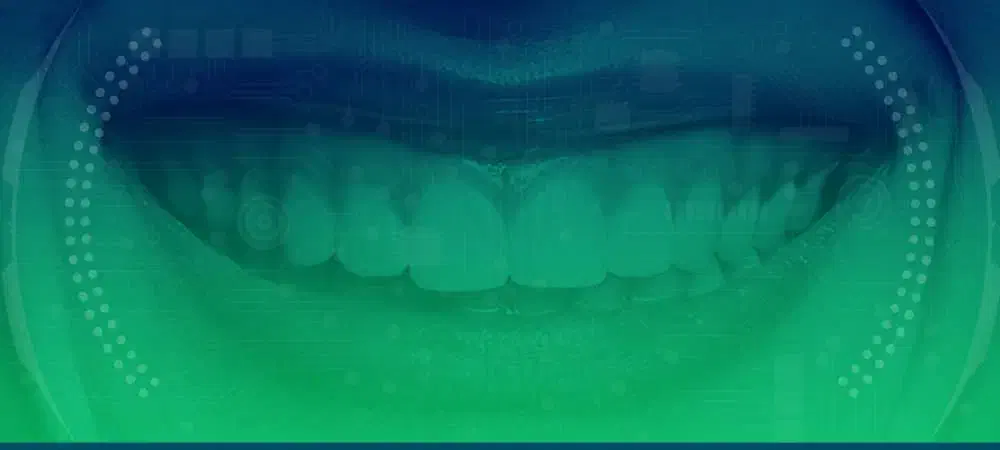 کامپوزیت، لمینت، ایمپلنت اقساط ویژه|خدمات آرایشگری و زیبایی|رشت, ساغری سازان|دیوار