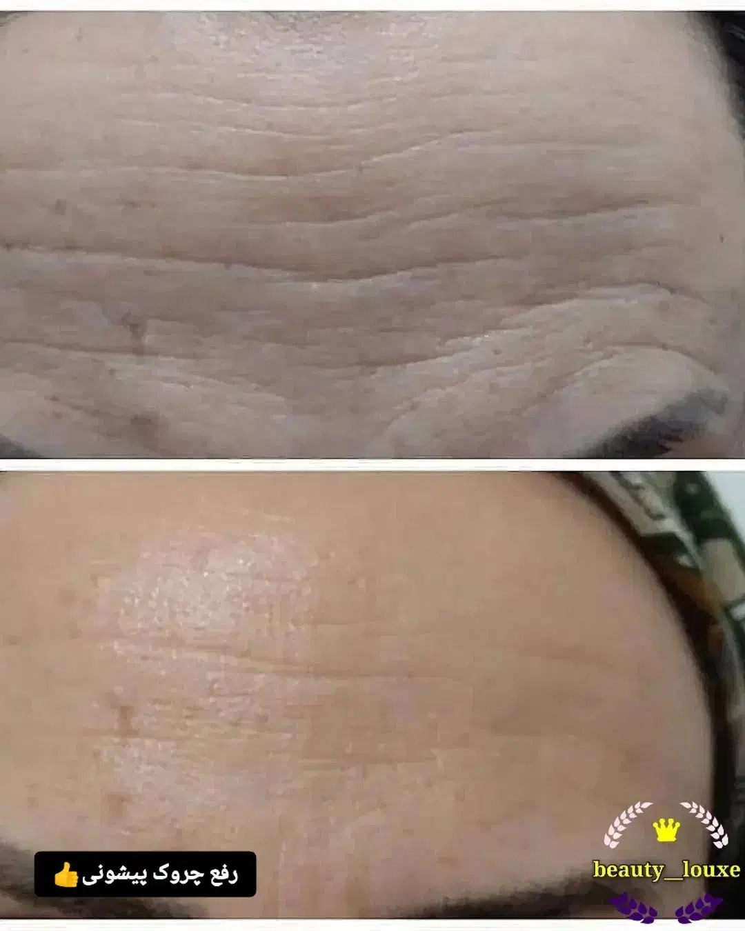 کرم لیفتینگ گاتیو|آرایشی، بهداشتی، درمانی|کرج, شهرک رضوانیه|دیوار