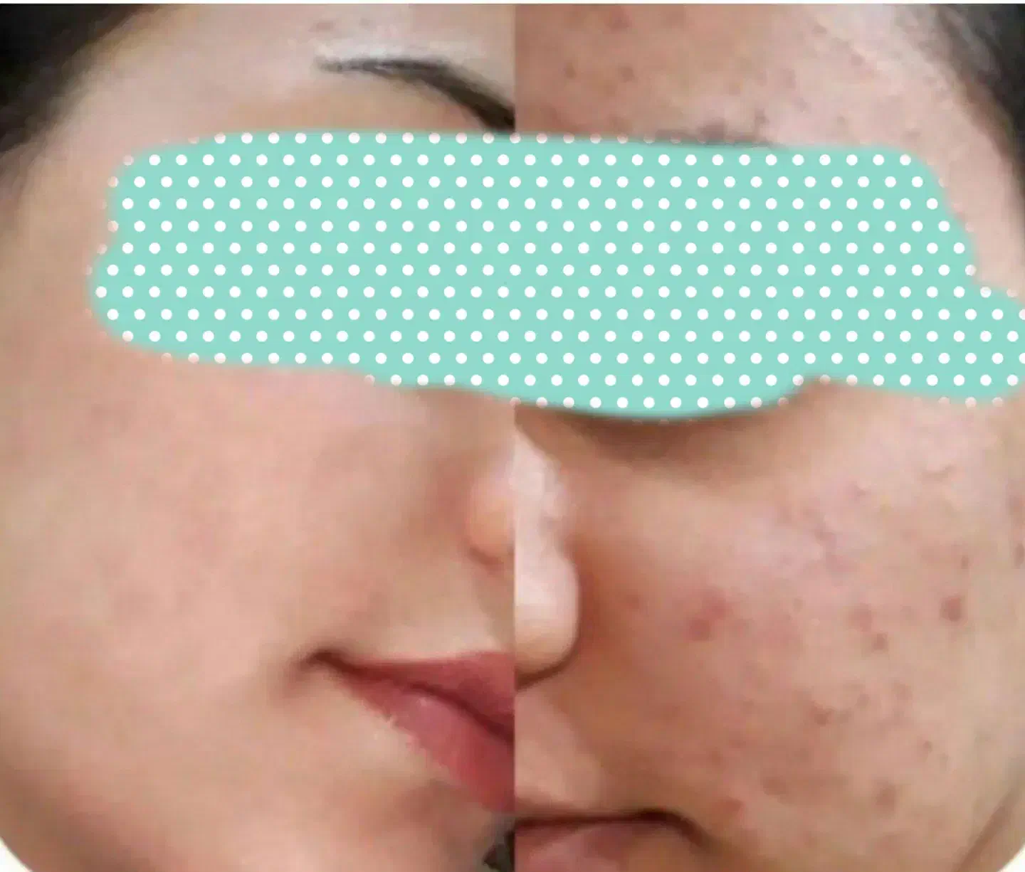 مثل کره چربی بسوزون و به اندام ایده آلت برس|آرایشی، بهداشتی، درمانی|جیرفت, |دیوار