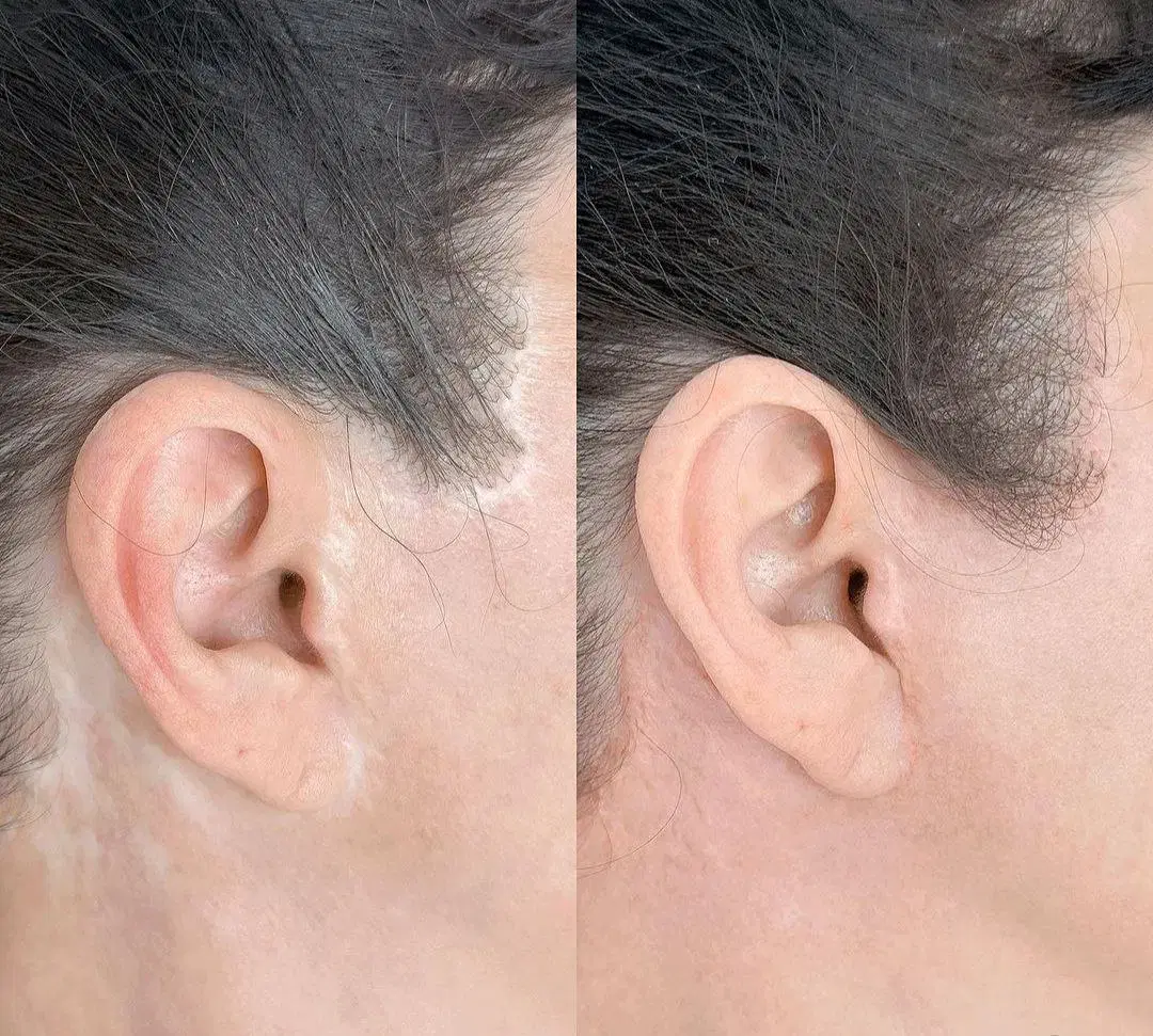 اولین مرکز تخصصی تاتوپزشکی بهشت|خدمات زیبایی و سلامت|تهران, عباسآباد|دیوار