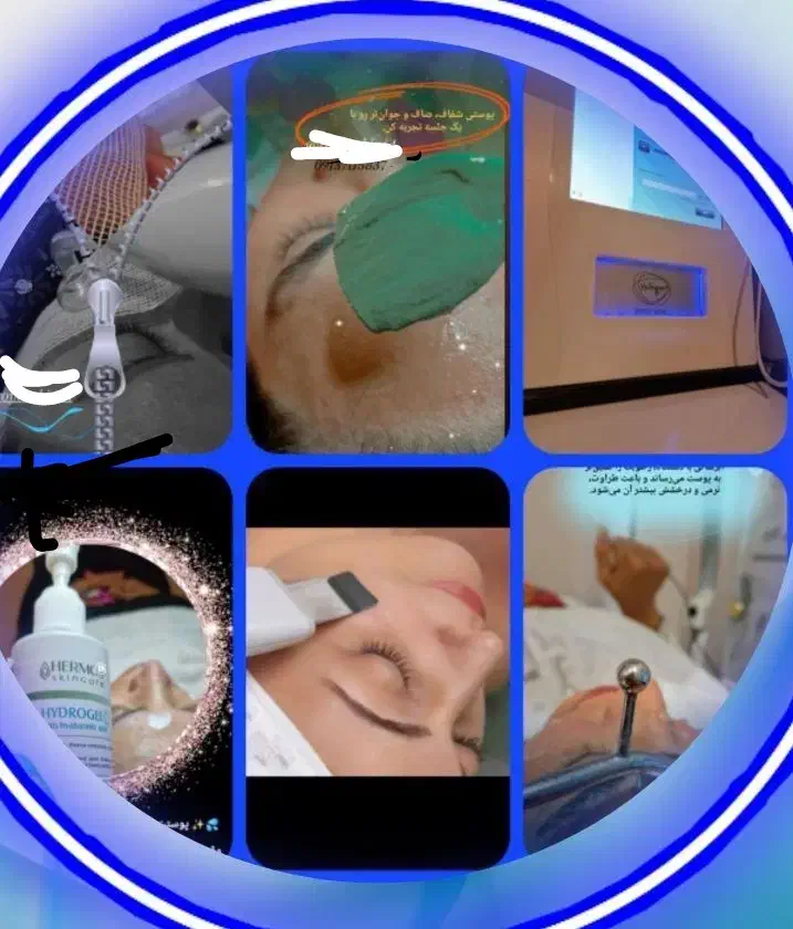 تخفیف فشیال vip بعلاوه دستگاه rf  فقط ۶۵۰|خدمات آرایشگری و زیبایی|شاهین‌شهر, عطار|دیوار