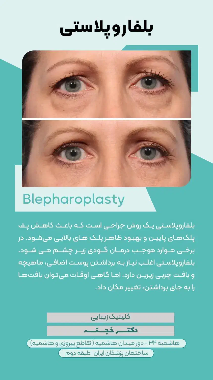 خدمات زیبایی برای زیباجویان عزیز|خدمات آرایشگری و زیبایی|چناران, |دیوار