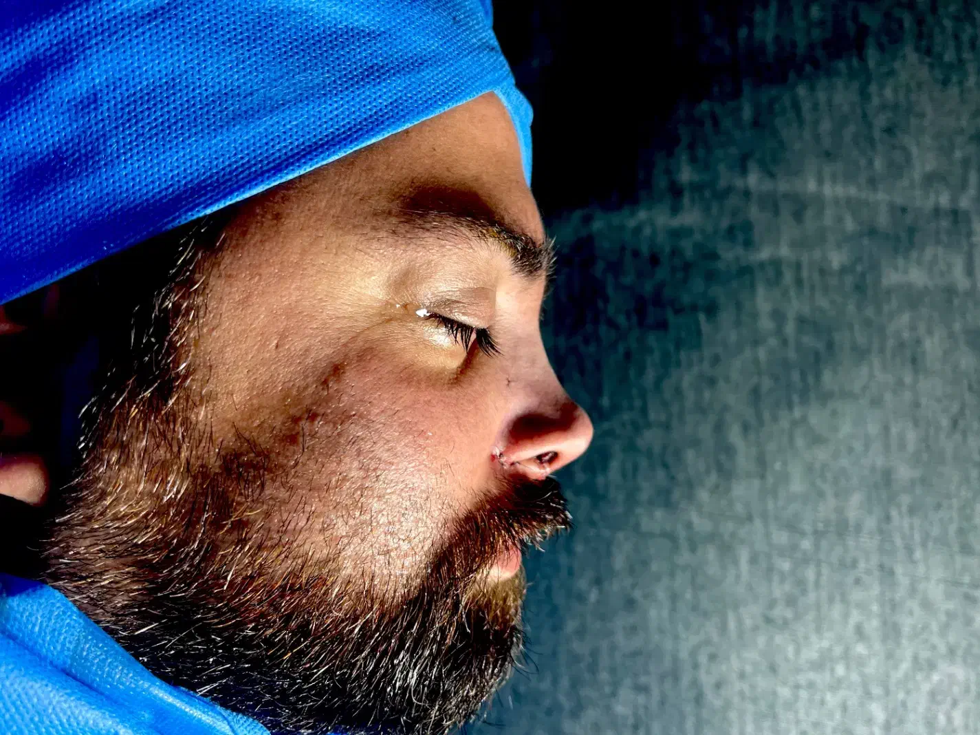 تیپ پلاستی ۱۶ بدون بیهوشی|خدمات آرایشگری و زیبایی|تهران, آسمان|دیوار