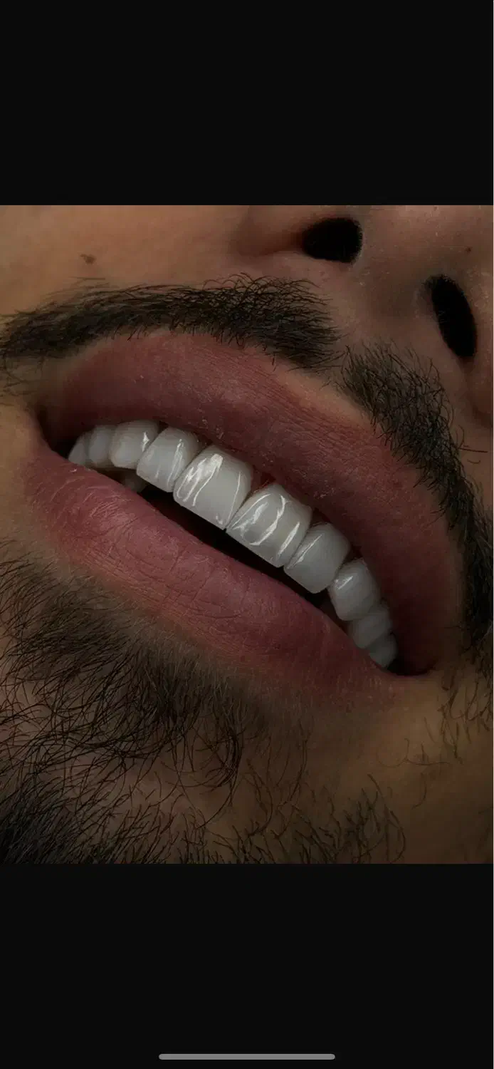 بزرگترین جشنواره تخفیفی کلینیک دندانپزشکی سرو|خدمات آرایشگری و زیبایی|تهران, قیطریه|دیوار