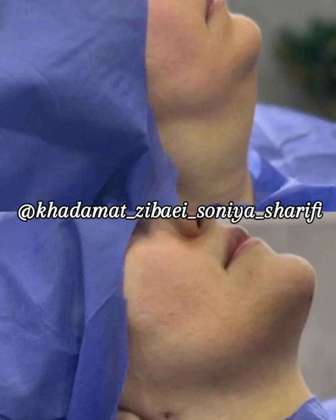 تخفیف ویژه ژل و بوتاکس تا یک هفته|خدمات آرایشگری و زیبایی|اهواز, منبع اب|دیوار