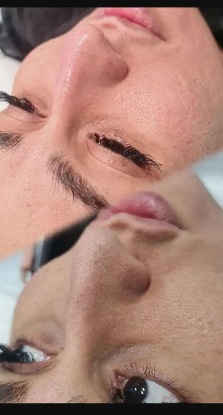 فیشیال (پاکسازی) خالبرداری و پلاسما صورت|خدمات آرایشگری و زیبایی|کوهدشت, |دیوار