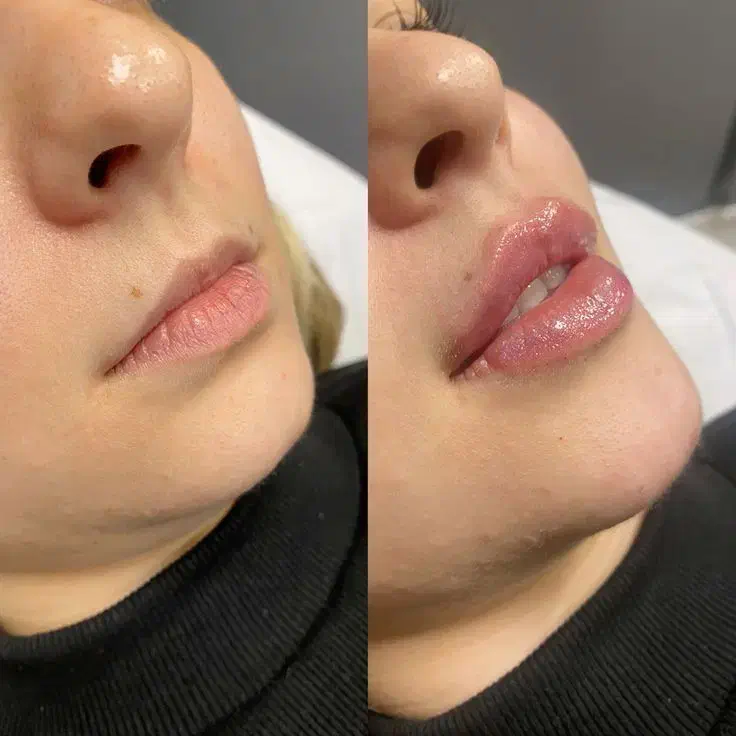 همه خدمات زیبایی ژل فیلر پیرسینگ خال بوتاکس ناخن|خدمات آرایشگری و زیبایی|قم, بنیاد|دیوار
