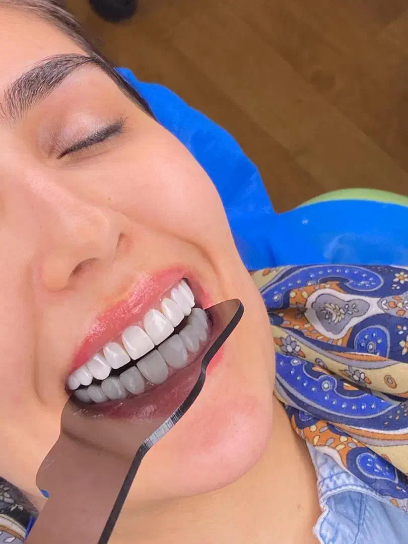 تخفیفات پاییزی کلینیک دیاموند|خدمات آرایشگری و زیبایی|زرندیه, |دیوار