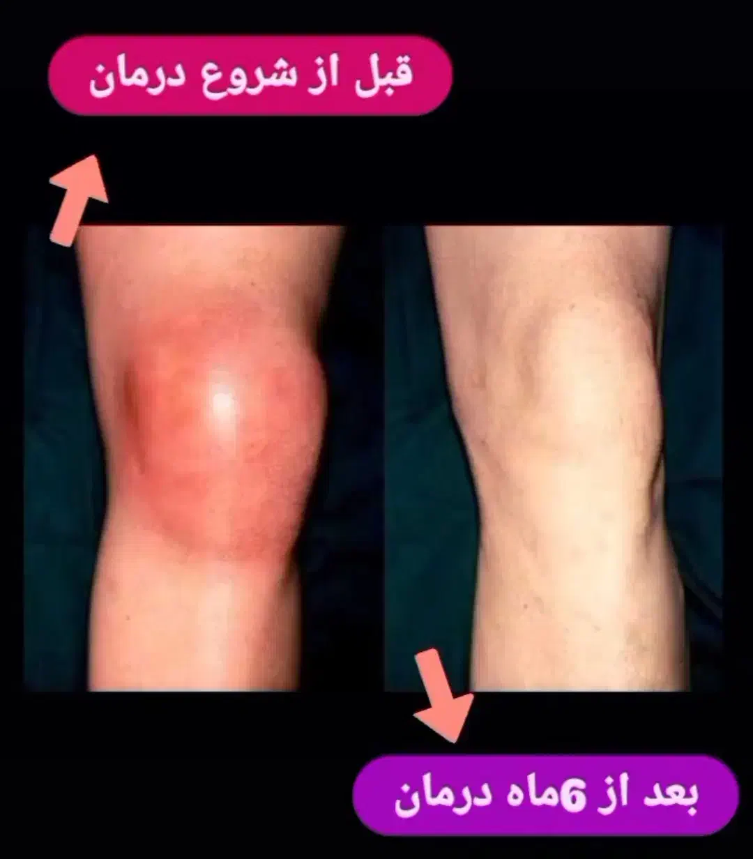 درمانگر بیماری روماتیسم و درد مفاصل|خدمات آرایشگری و زیبایی|اصفهان, شهرک سلامت|دیوار