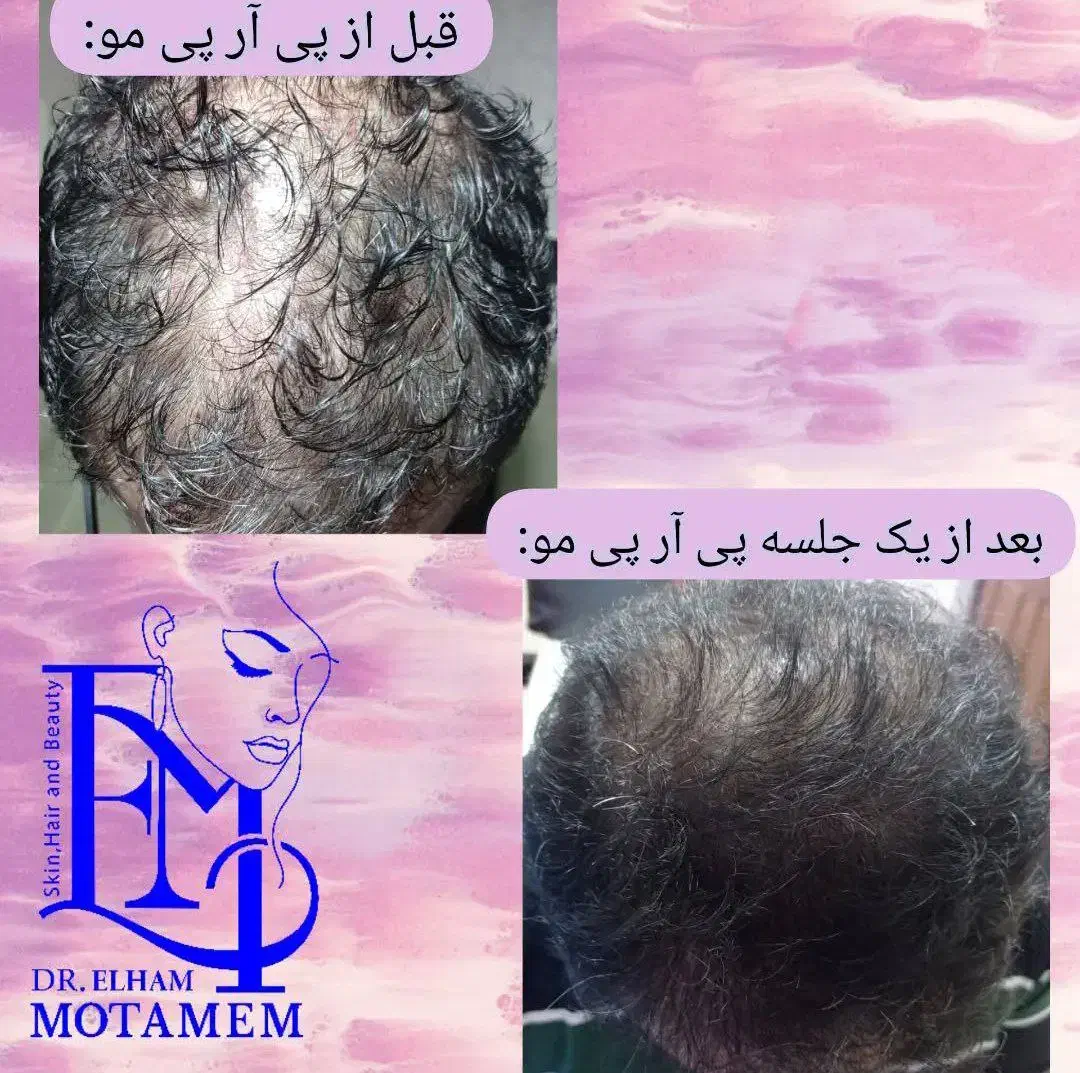 مطب پوست،مو،زیبایی دکتر الهام متمم|خدمات آرایشگری و زیبایی|رشت, گلسار|دیوار